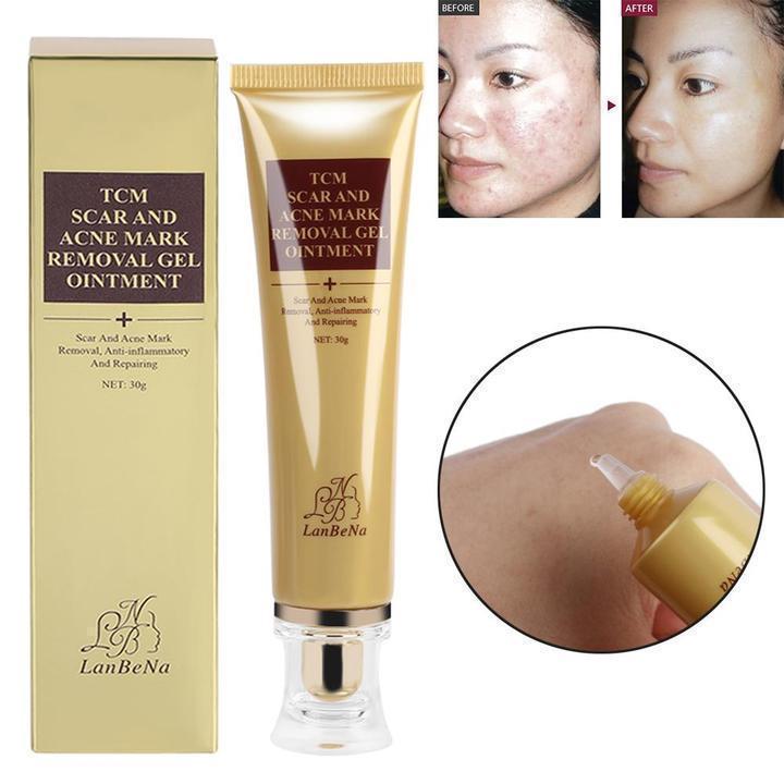 Acne Scar Removal Cream